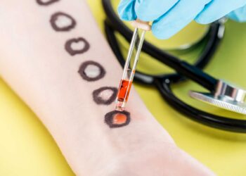 Kan Testi ile Kanser Riskini Belirleme: Yeni Bir Umut