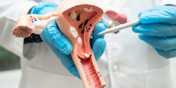 Prostat Kanseri Taramasında Yeni Dönem